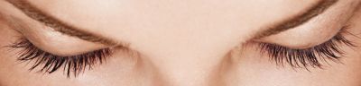Latisse - After